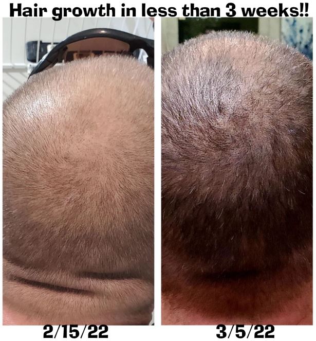 Hair-Growth-in-3-weeks